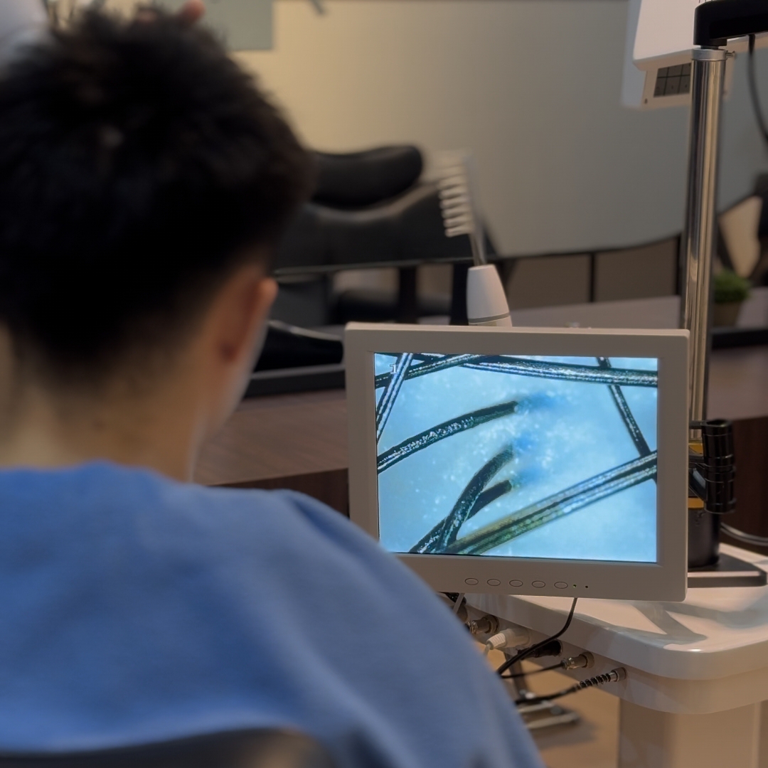 Malaysia Scalp & Hair Follicle Analysis